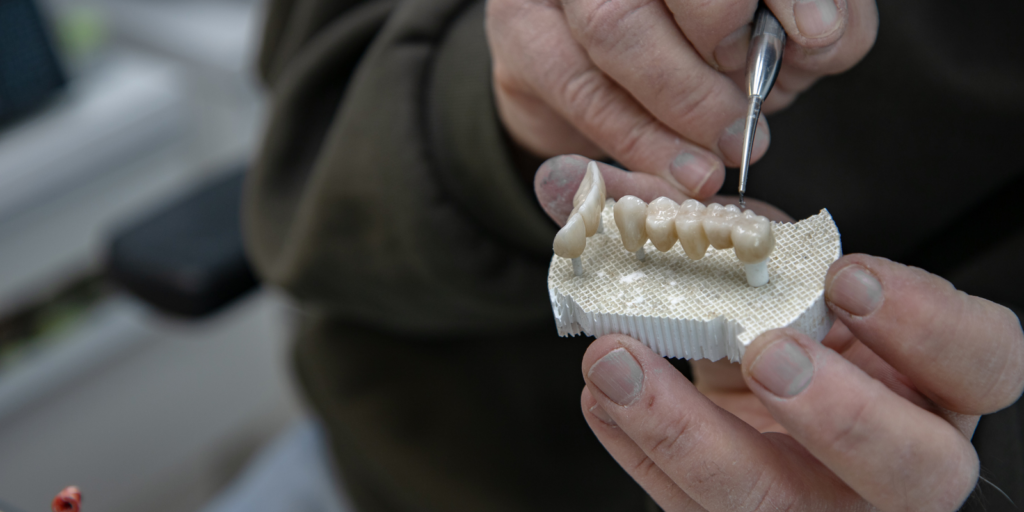 Implants dentaires et couronnes à Montréal – Clinique Ecodentaire